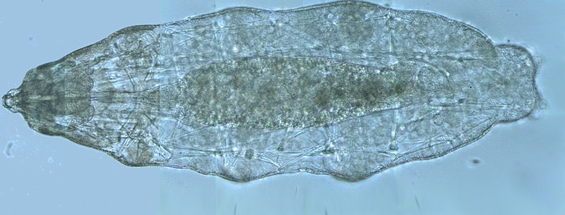 Macrobiotus sp.